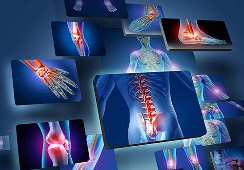 Afbeelding van Röntgen foto's